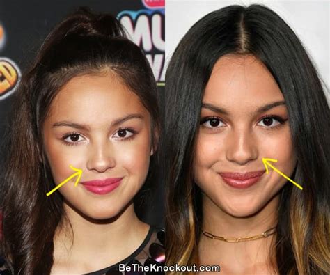 did olivia rodrigo get breast implants|Olivia Rodrigo, Before and After